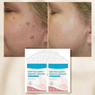 Natural Organic Skin Plasters For Skin Care Moles Warts And Daily Use | Garrison