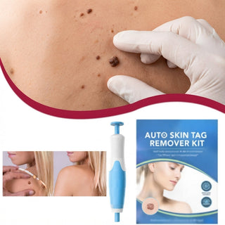 Skin Tag And Wart Remover For Body With Fast Visible Results | Weldon