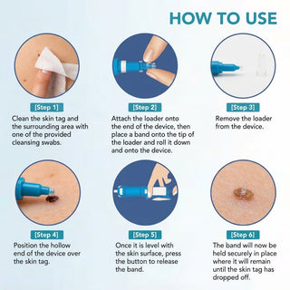 Skin Tag And Wart Remover For Body With Fast Visible Results | Weldon