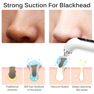 Rechargeable Pore Cleanser With 6 Interchangeable Heads And Adjustable Suction Power | Ashcroft