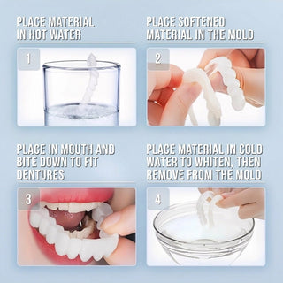 Clip On Smile Veneers With Upper And Lower Set For Dental Appearance Cover | Greycroft